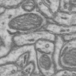 EM Mitochondira Image