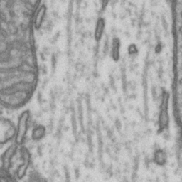 EM Mitochondira Image