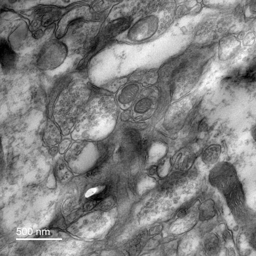 EM Mitochondira Image