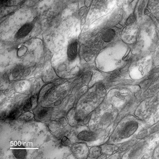 EM Mitochondira Image