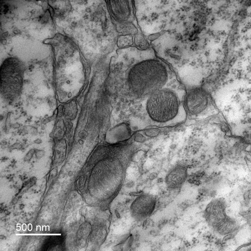 EM Mitochondira Image